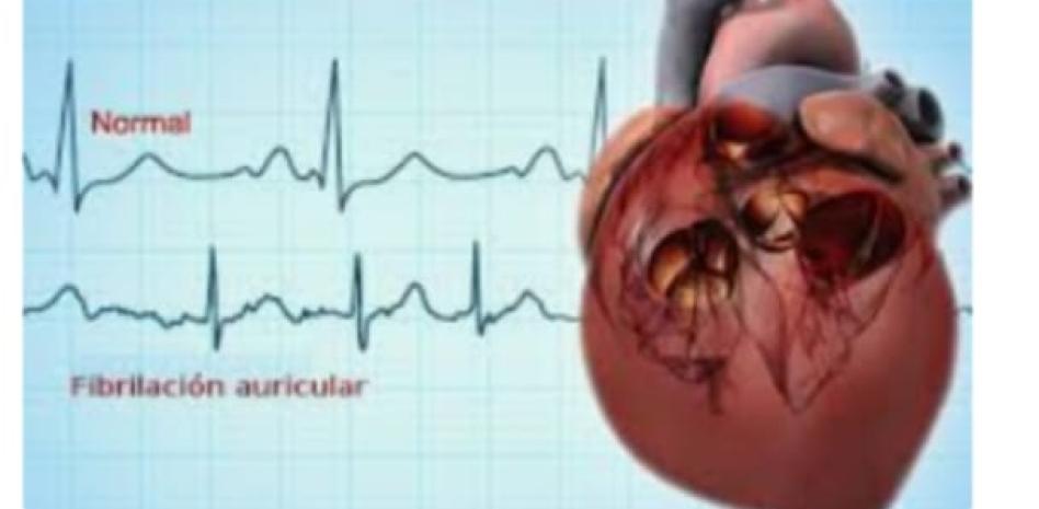 Vigilar la salud personal obliga a un chequeo anual del corazón para evitar complicaciones