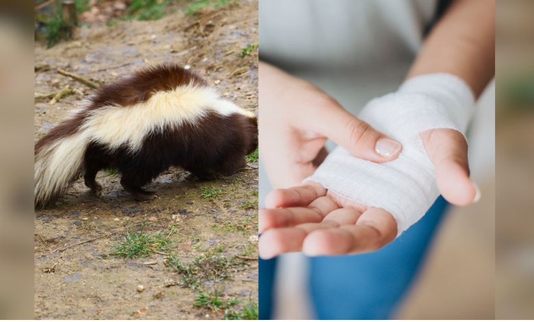 Mujer fallece de rabia por la mordedura de un zorrillo en Zacatecas