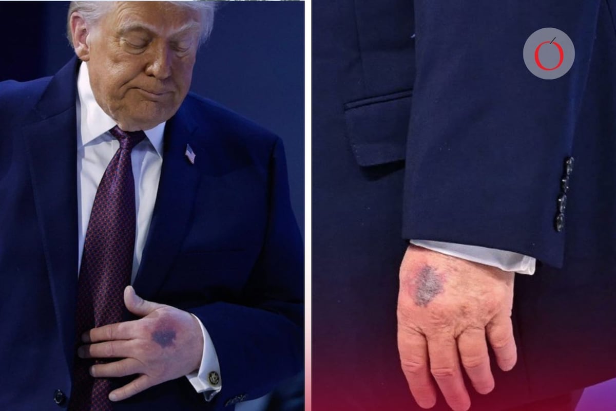 La extraña caída del presidente Trump y las revelaciones que surgen sobre su salud